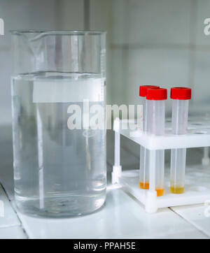 Laboratory equipment for blood analysis. The real work of the laboratory assistant in the hospital. Close-up. Stock Photo