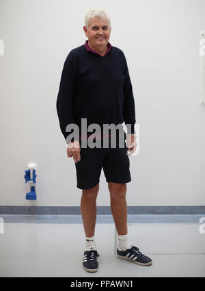 Embargoed to 1700 Monday September 24 Barry Dolling, aged 65, from Selsdon, Surrey, who was diagnosed with prostate cancer in April 2018 is the first patient in the UK to receive a pioneering new form of radiotherapy - using a Magnetic Resonance Linear Accelerator (MR Linac) machine - at the Royal Marsden Hospital in Sutton Surrey. Stock Photo