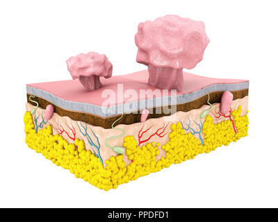 3d Illustration of Polype with Skin structure, isolated white background Stock Photo