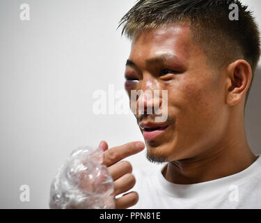 Nagoya, Aichi, Japan. 24th Sep, 2018. Sho Kimura (JPN) Boxing : Sho Kimura of Japan is interviewed by the press after losing the WBO flyweight title bout at Takeda Teva Ocean Arena in Nagoya, Aichi, Japan . Credit: Hiroaki Yamaguchi/AFLO/Alamy Live News Stock Photo