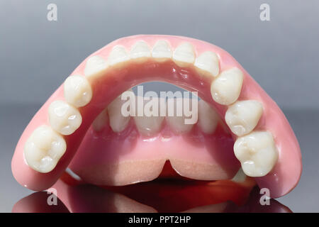 Medical denture jaw teeth isolated on gray background Stock Photo