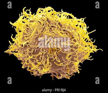 Mesenchymal stem cell. Coloured scanning electron micrograph (SEM) of a human mesenchymal stem cell (MSC). MSCs are multipotent stromal (connective tissue) cells that can differentiate into a variety of cell types, including osteoblasts (bone cells), chondrocytes (cartilage cells), and adipocytes (fat cells). The youngest, most primitive MSCs can be obtained from the umbilical cord tissue. Magnification: x3000 when printed 10 centimetres wide. Stock Photo