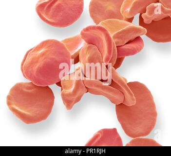 Coloured scanning electron micrograph (SEM) of red blood cells (RBCs, erythrocytes). Red blood cells are biconcave, disc-shaped cells that transport oxygen from the lungs to body cells. They circulate in the blood and also remove carbon dioxide to the lungs for exhalation. Their red colour is due to the oxygen-carrying protein haemoglobin. Red blood cells, the most abundant cell in the blood, have no nucleus and are about 7 micrometres across. Magnification: x3500 when printed at 10 centimetres across. Stock Photo