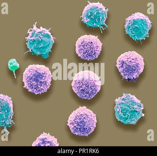 White blood cells and a platelet. Coloured scanning electron micrograph (SEM) of white blood cells and a single platelet (blue). Platelets are fragments of white blood cells that under normal circumstances are small and biconcave in form. However, if there is a break in the surface of a blood vessel the platelets come into contact with molecules they are not used to and become activated. Magnification: x3000 when printed at 10 centimetres wide. Stock Photo