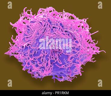 Mesenchymal stem cell. Coloured scanning electron micrograph (SEM) of a human mesenchymal stem cell (MSC). MSCs are multipotent stromal (connective tissue) cells that can differentiate into a variety of cell types, including osteoblasts (bone cells), chondrocytes (cartilage cells), and adipocytes (fat cells). The youngest, most primitive MSCs can be obtained from the umbilical cord tissue. Magnification: x3000 when printed 10 centimetres wide. Stock Photo