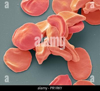 Coloured scanning electron micrograph (SEM) of red blood cells (RBCs, erythrocytes). Red blood cells are biconcave, disc-shaped cells that transport oxygen from the lungs to body cells. They circulate in the blood and also remove carbon dioxide to the lungs for exhalation. Their red colour is due to the oxygen-carrying protein haemoglobin. Red blood cells, the most abundant cell in the blood, have no nucleus and are about 7 micrometres across. Magnification: x3500 when printed at 10 centimetres across.