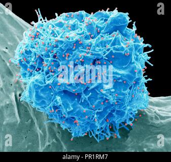 HIV infected cell. Coloured scanning electron micrograph (SEM) of a 293T cell infected with the human immunodeficiency virus (HIV, red dots). Small spherical virus particles, visible on the surface, are in the process of budding from the cell membrane. Any non highlighted vesicles of uneven shape are exosomes, thought to be involved in cell communication and transmission of disease, and under investigation as a means of drug delivery. Magnification: x6600 at 10cm wide. Specimen courtesy of Greg Towers, University College London, UK.
