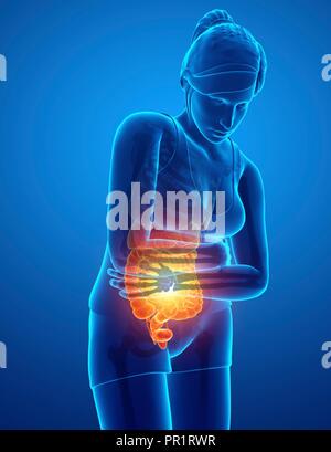 Woman with abdominal pain, computer illustration. Stock Photo