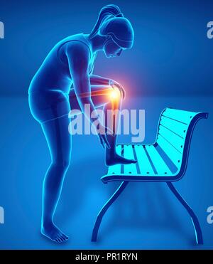 Woman with knee pain, computer illustration. Stock Photo