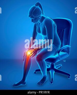 Woman with knee pain, computer illustration. Stock Photo