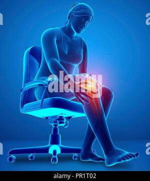 Woman with knee pain, computer illustration. Stock Photo