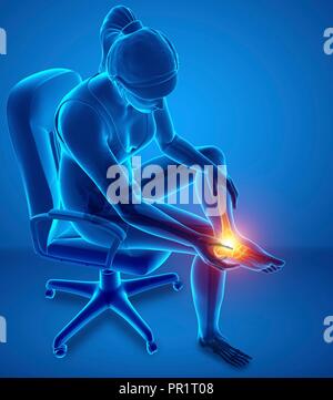 Woman with foot pain, computer illustration. Stock Photo