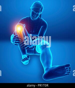 Woman with knee pain, computer illustration. Stock Photo