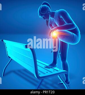 Woman with knee pain, computer illustration. Stock Photo