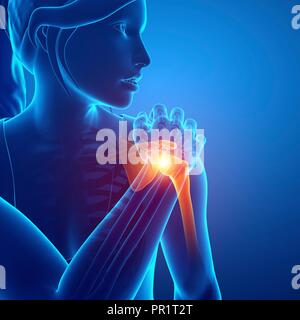 Woman with shoulder pain, computer illustration. Stock Photo