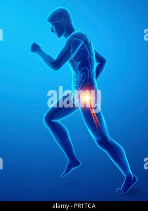 Man with hip pain, computer illustration. Stock Photo