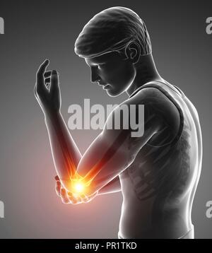 Man with elbow pain, computer illustration. Stock Photo