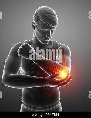 Man with elbow pain, computer illustration. Stock Photo