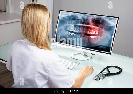 Female Dentist Examining Teeth X-ray On Computer Over Desk In Clinic Stock Photo