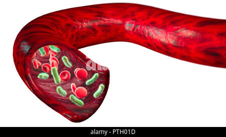 Vein and red blood cells attacked by a virus, circulation of bacteria within an artery. Escherichia coli. Section of a vein. 3d rendering Stock Photo