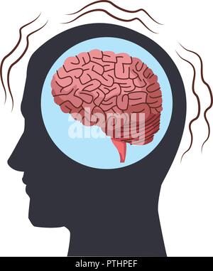 Alzheimer brain inside head silhouette Stock Vector Image & Art - Alamy