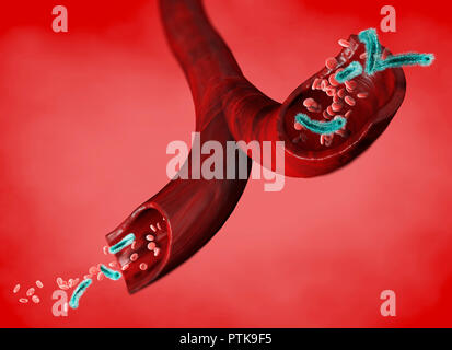 Vein and red blood cells attacked by a virus, circulation of bacteria within an artery. Escherichia coli. Section of a vein. 3d rendering Stock Photo