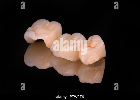 dental ceramic veneers and crowns isolated with mirror background. Stock Photo