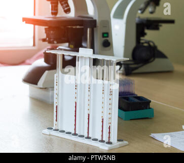 blood test for ESR microscopes, medicine and blood, virus nipah Stock Photo