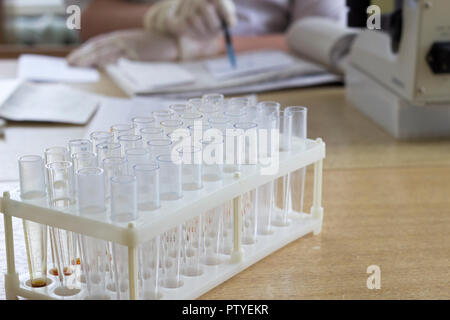 medical test tubes close-up, microscope, hands, percussion Stock Photo