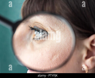 Scars on the face of a girl through a magnifying glass, close-up Stock Photo