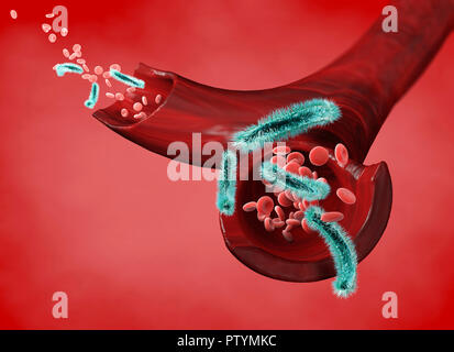 Vein and red blood cells attacked by a virus, circulation of bacteria within an artery. Escherichia coli. Section of a vein. Stock Photo