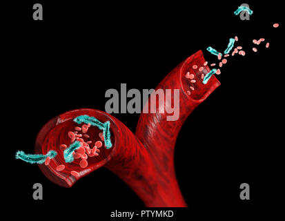 Vein and red blood cells attacked by a virus, circulation of bacteria within an artery. Escherichia coli. Section of a vein. Stock Photo