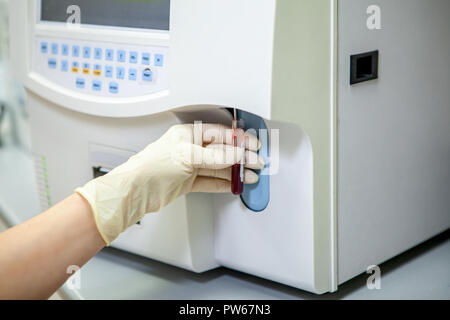 a laboratory specialist holds a test tube of blood during the collection of a special apparatus for analysis, close-up Stock Photo
