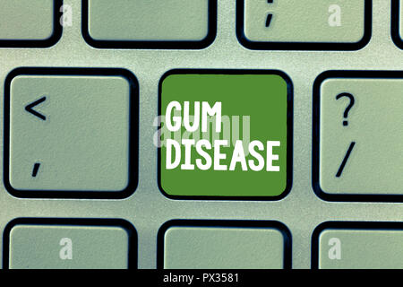 Text sign showing Gum Disease. Conceptual photo Inflammation of the soft tissue Gingivitis Periodontitis. Stock Photo