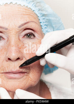 The surgeon doing skin check on mid age woman before plastic surgery. Senior female model. plastic surgery, lifting, aging concept Stock Photo