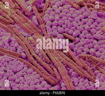 Tongue bacteria. Coloured scanning electron micrograph (SEM) of ...