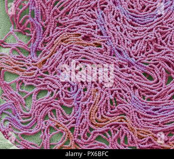 Sputum. Scanning electron micrograph (SEM) of a bacterial culture from sputum. Phlegm is a secretion in the airway during disease and inflammation. Ph Stock Photo