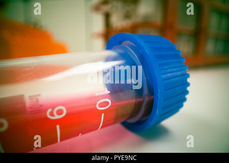 Blood samples for research test  tube of blood Stock Photo