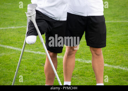 close-up of ampute soccer player and team friend Stock Photo