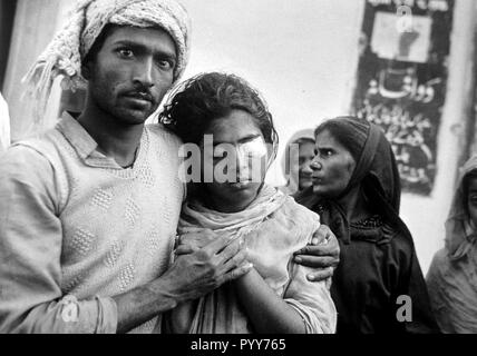 man with wife eyes bandage damaged, Bhopal, madhya pradesh, India, Asia, old vintage 1984 picture Stock Photo