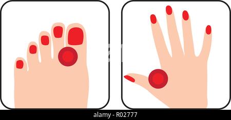 Painful and inflamed foot and hand Stock Vector