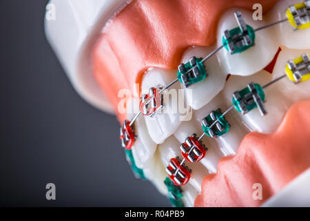 Close-up of a orthodontic model jaws and teeth with braces. Stock Photo
