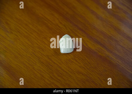 Tooth, metal ceramic crown on the table. Denture made of metal ceramics. Stock Photo