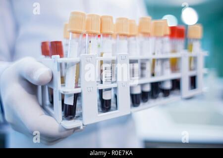 Laboratory assistant holding medical samples in rack, close up. Stock Photo