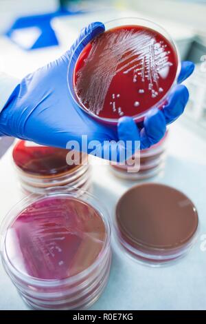 Laboratory assistant examining growth on a petri dish, close up. Stock Photo