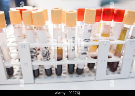 Medical samples in rack, close up. Stock Photo