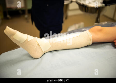A little boy with ADHD, Autism, Aspergers Syndrome with a broken leg waits to have it put in plaster at the hospital Stock Photo