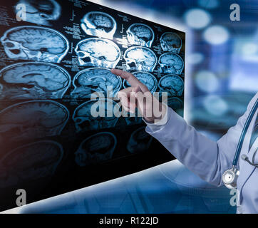 doctor pointing finger to CT scan film, medical concept Stock Photo