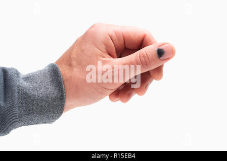 Black nail. Hammer on the thumb. Pain and hematoma after injury. Male hand isolated on white background Stock Photo