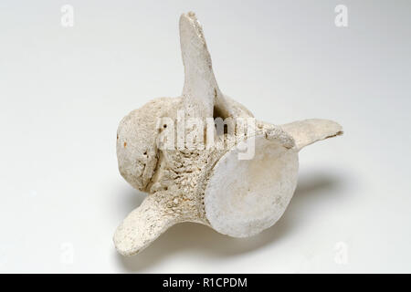 Whale vertebra with old harpoon wound calcified as a bony growth where the blade broke. Bears testament to the intensity of whaling in the 19th C Stock Photo